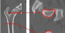 PM-使用定量CT对比格犬进行骨矿物骨密度测量：对比金标准双能X射线吸收技术-Korea